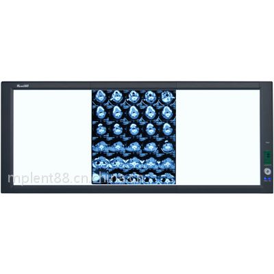 医疗医用看片灯智能调光型LED观片灯图3