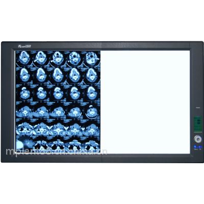 医疗医用看片灯智能调光型LED观片灯图2